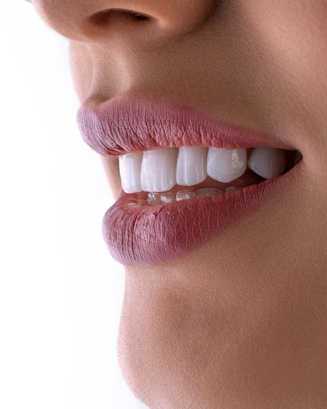 Sonrisa de dientes blancos y parejos