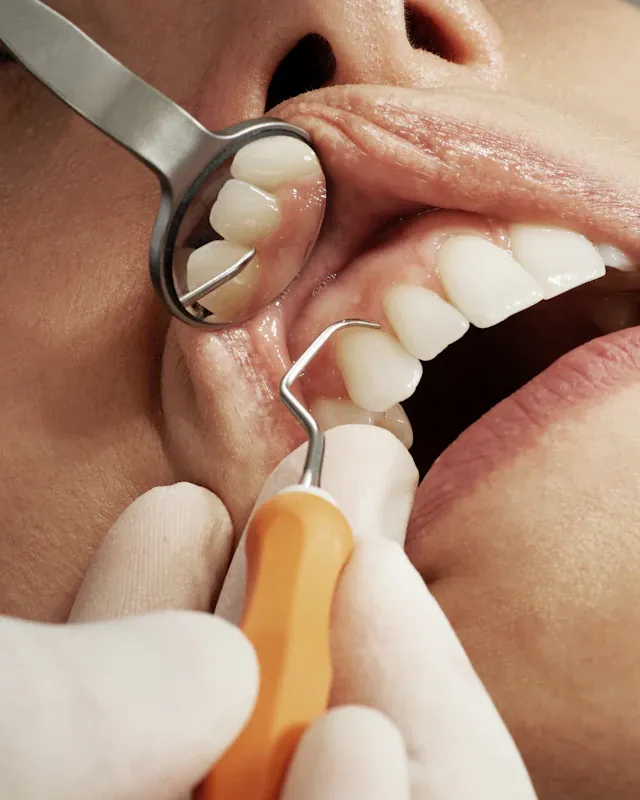 Limpieza dental profesional con espejo e instrumental
